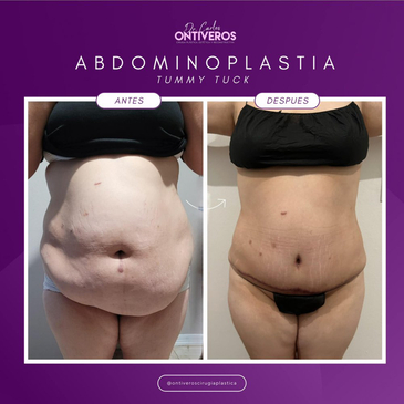 Slider image (6) Dr. Carlos Ontiveros